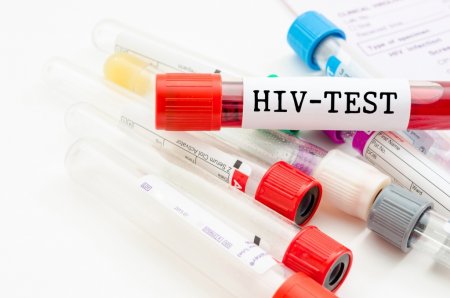 #FDA одобрило тест на ВИЧ, который также измеряет и вирусную нагрузку.