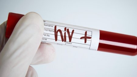 О том, почему ВИЧ-положительные скрывают свой статус
